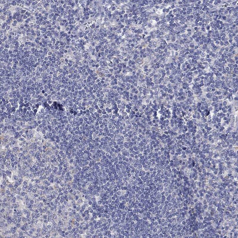 LASS1 Antibody - BSA Free Immunohistochemistry: LASS1 Antibody - BSA Free [NBP1-92067]