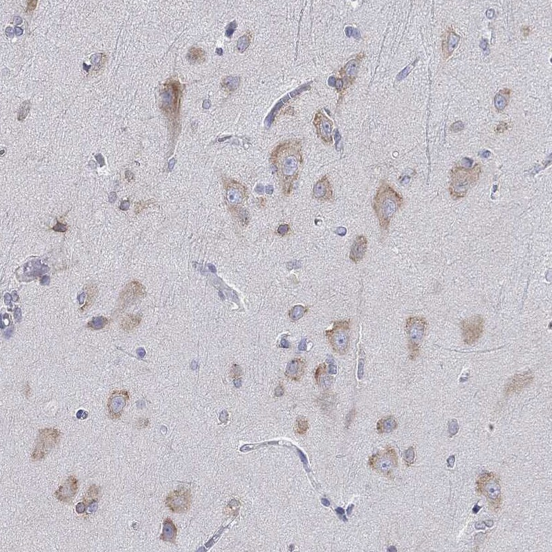 LASS1 Antibody - BSA Free Immunohistochemistry: LASS1 Antibody - BSA Free [NBP1-92067]