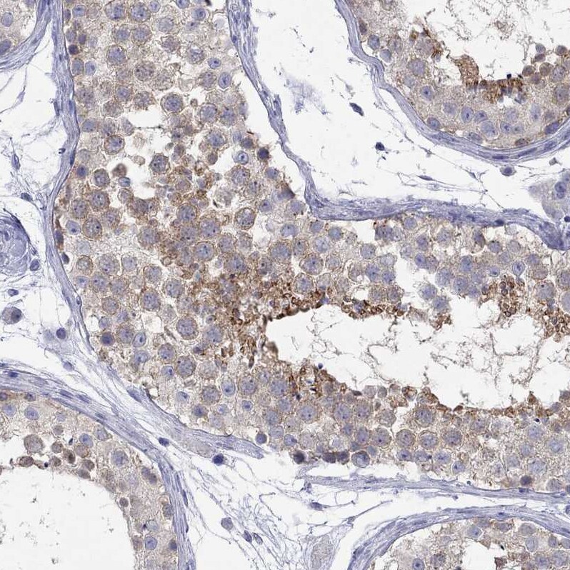 LASS1 Antibody - BSA Free Immunohistochemistry: LASS1 Antibody - BSA Free [NBP1-92067]