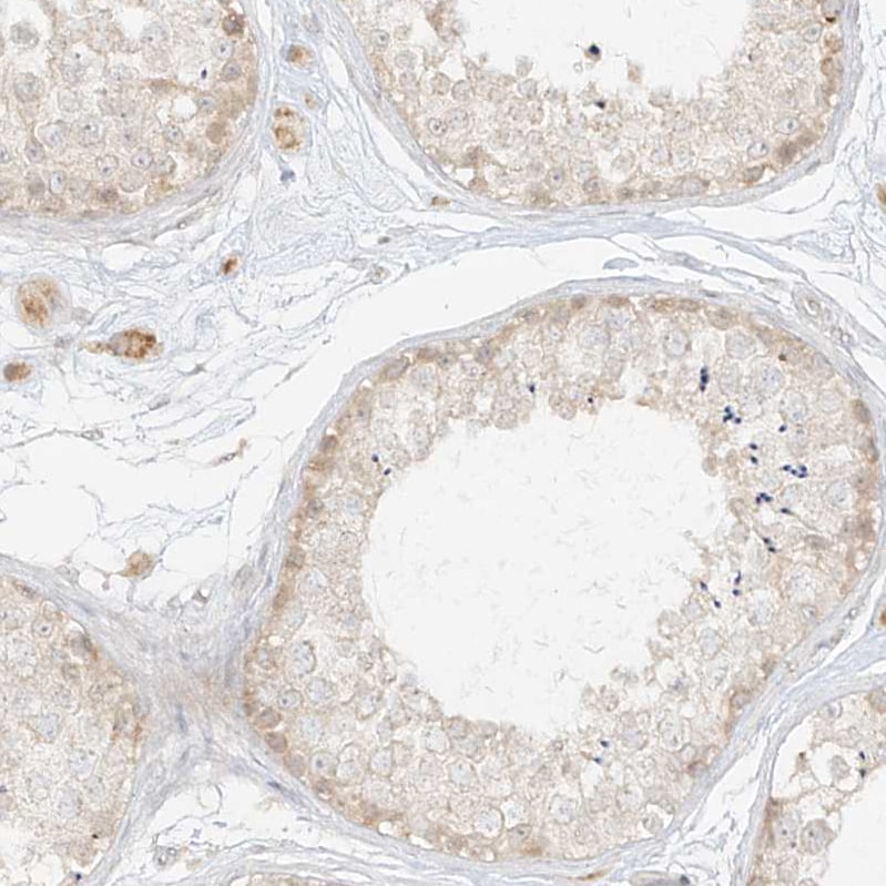 lipoyltransferase 1 Antibody - BSA Free Immunohistochemistry-Paraffin: lipoyltransferase 1 Antibody [NBP1-92073]