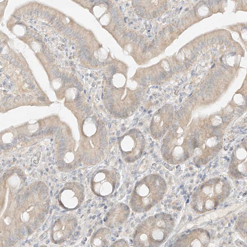 lipoyltransferase 1 Antibody - BSA Free Immunohistochemistry-Paraffin: lipoyltransferase 1 Antibody [NBP1-92073]