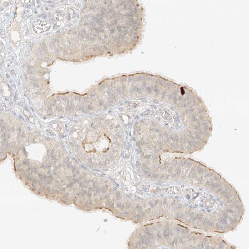 lipoyltransferase 1 Antibody - BSA Free Immunohistochemistry-Paraffin: lipoyltransferase 1 Antibody [NBP1-92073]