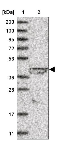 lipoyltransferase 1 Antibody - BSA Free Western Blot: lipoyltransferase 1 Antibody - BSA Free [NBP1-92073]