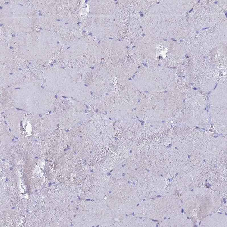 REXO5 Antibody - BSA Free Immunohistochemistry: REXO5 Antibody - BSA Free [NBP1-92075]