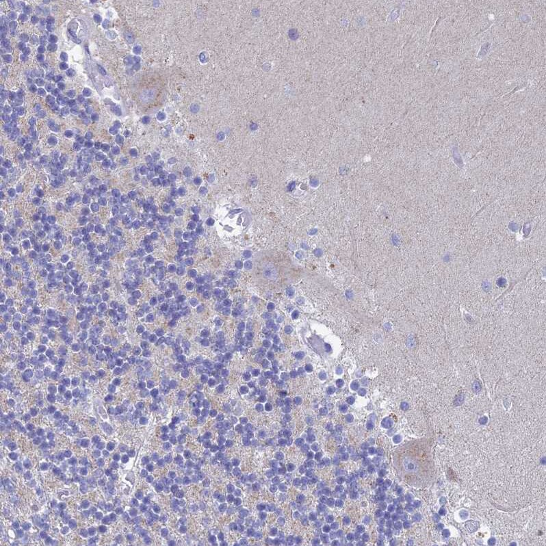 REXO5 Antibody - BSA Free Immunohistochemistry: REXO5 Antibody - BSA Free [NBP1-92075]