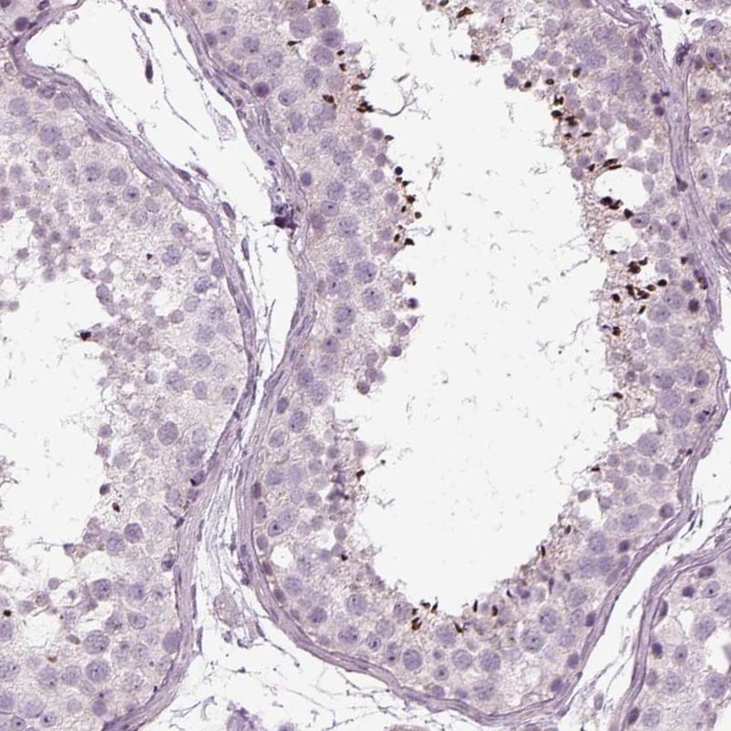 LRRC44 Antibody - BSA Free Immunohistochemistry-Paraffin: LRRC44 Antibody [NBP1-92078]