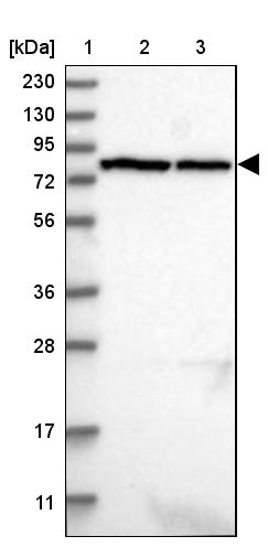 LRRC44 Antibody - BSA Free Western Blot: LRRC44 Antibody - BSA Free [NBP1-92078]