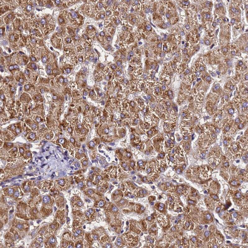 LRRIQ1 Antibody - BSA Free Immunohistochemistry: LRRIQ1 Antibody - BSA Free [NBP1-92080]