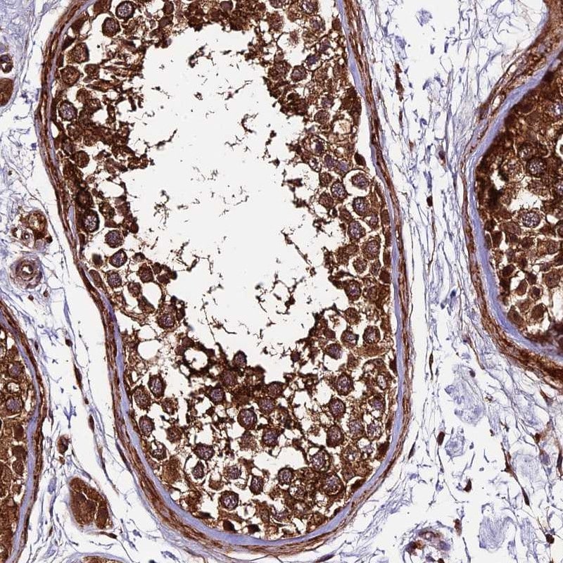 LSM7 Antibody - BSA Free Immunohistochemistry: LSM7 Antibody - BSA Free [NBP1-92084]