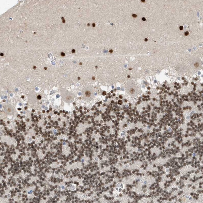 Macro H2A.2 Antibody - BSA Free Immunohistochemistry: Macro H2A.2 Antibody - BSA Free [NBP1-92094]
