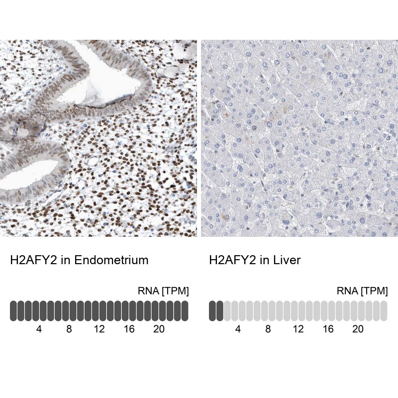 Macro H2A.2 Antibody - BSA Free Immunohistochemistry: Macro H2A.2 Antibody - BSA Free [NBP1-92094]