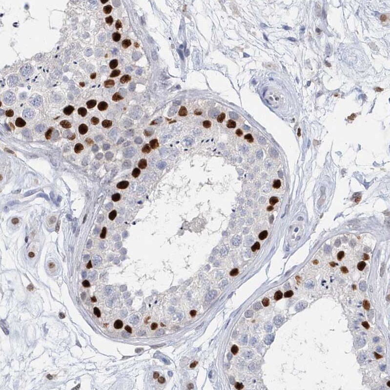 Macro H2A.2 Antibody - BSA Free Immunohistochemistry: Macro H2A.2 Antibody - BSA Free [NBP1-92094]