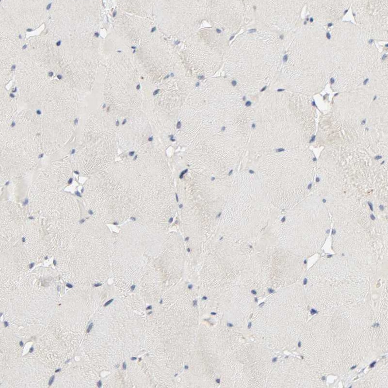 MAGEA8 Antibody - BSA Free Immunohistochemistry: MAGEA8 Antibody - BSA Free [NBP1-92097]