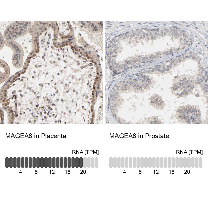 MAGEA8 Antibody - BSA Free Immunohistochemistry: MAGEA8 Antibody - BSA Free [NBP1-92097]