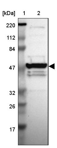 MGC13138 Antibody - BSA Free Western Blot: MGC13138 Antibody - BSA Free [NBP1-92115]