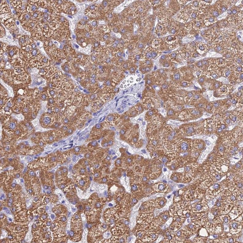 Microsomal Glutathione S-transferase 1 Antibody - BSA Free Immunohistochemistry: Microsomal Glutathione S-transferase 1 Antibody - BSA Free [NBP1-92116]