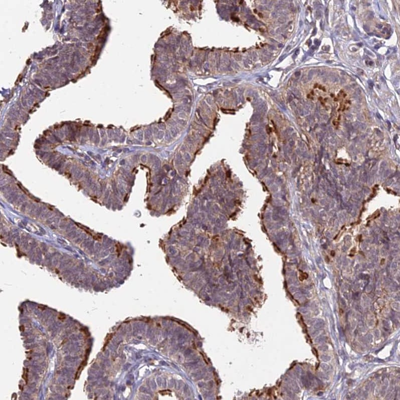 APBA3/Mint-3 Antibody - BSA Free Immunohistochemistry: APBA3/Mint-3 Antibody - BSA Free [NBP1-92117]