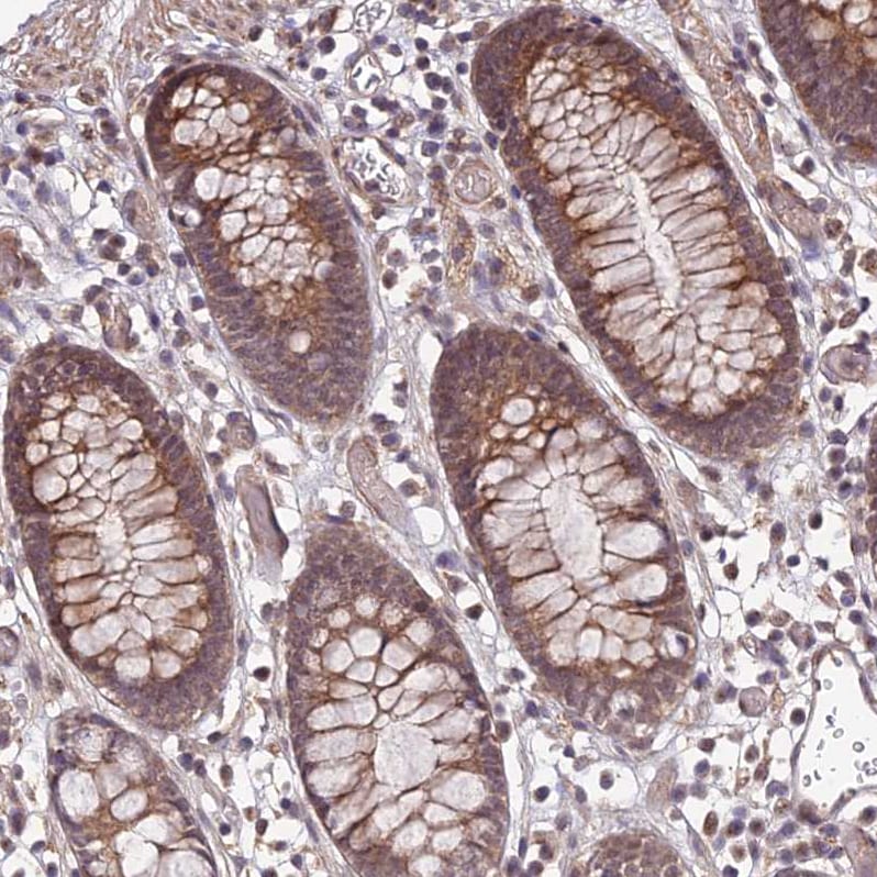 APBA3/Mint-3 Antibody - BSA Free Immunohistochemistry: APBA3/Mint-3 Antibody - BSA Free [NBP1-92117]
