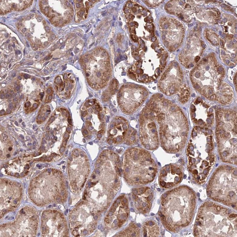 APBA3/Mint-3 Antibody - BSA Free Immunohistochemistry: APBA3/Mint-3 Antibody - BSA Free [NBP1-92117]