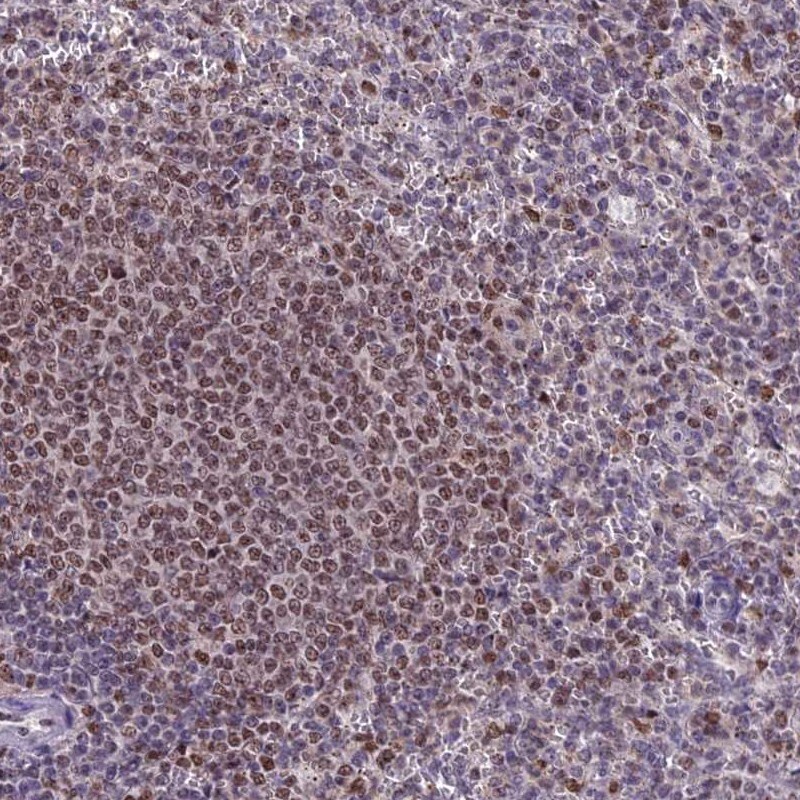 MIS12 Antibody - BSA Free Immunohistochemistry: MIS12 Antibody - BSA Free [NBP1-92118]