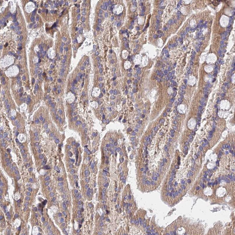 mitochondrial ribosomal protein L35 Antibody - BSA Free Immunohistochemistry: mitochondrial ribosomal protein L35 Antibody - BSA Free [NBP1-92119]