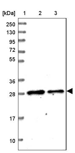 Mitocondrial Translational Initiation Factor 3 Antibody - BSA Free Western Blot: Mitocondrial Translational Initiation Factor 3 Antibody - BSA Free [NBP1-92121]