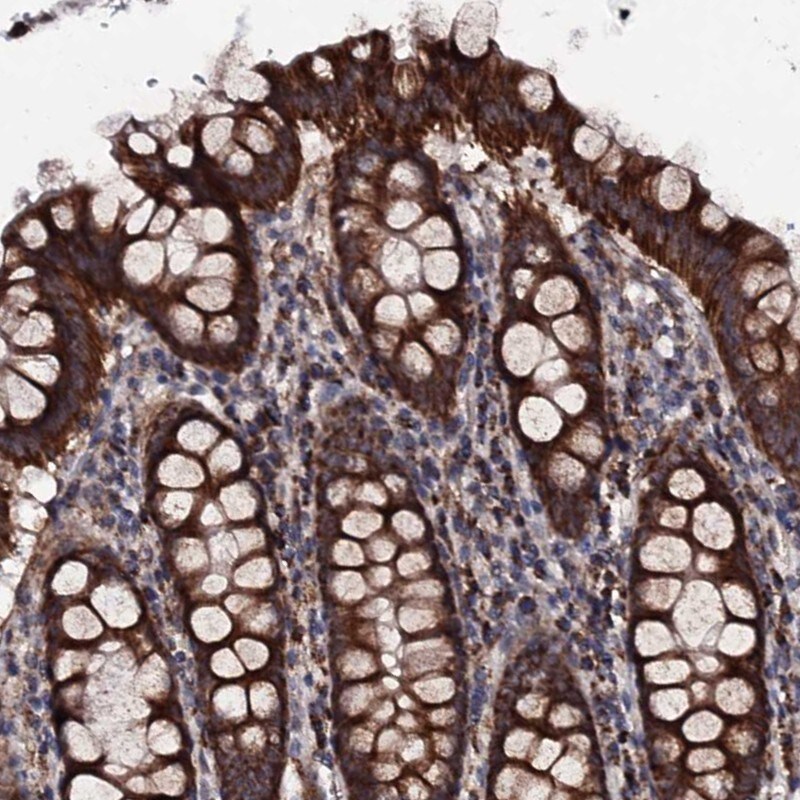Mitocondrial Translational Initiation Factor 3 Antibody - BSA Free Immunohistochemistry: Mitocondrial Translational Initiation Factor 3 Antibody - BSA Free [NBP1-92121]