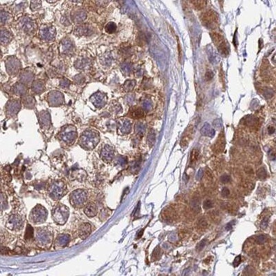 MKKS Antibody - BSA Free Immunohistochemistry-Paraffin: MKKS Antibody [NBP1-92122]
