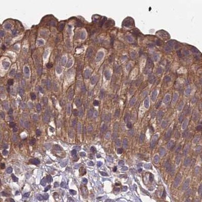 MKKS Antibody - BSA Free Immunohistochemistry-Paraffin: MKKS Antibody [NBP1-92122]