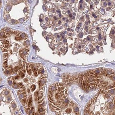 MKKS Antibody - BSA Free Immunohistochemistry-Paraffin: MKKS Antibody [NBP1-92122]