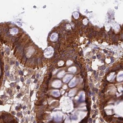 MKKS Antibody - BSA Free Immunohistochemistry-Paraffin: MKKS Antibody [NBP1-92122]