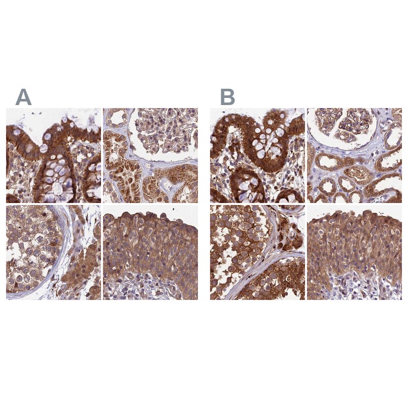 MKKS Antibody - BSA Free Immunohistochemistry-Paraffin: MKKS Antibody [NBP1-92122]