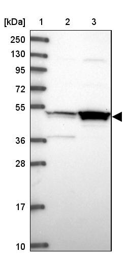 MKKS Antibody - BSA Free Western Blot: MKKS Antibody - BSA Free [NBP1-92123]
