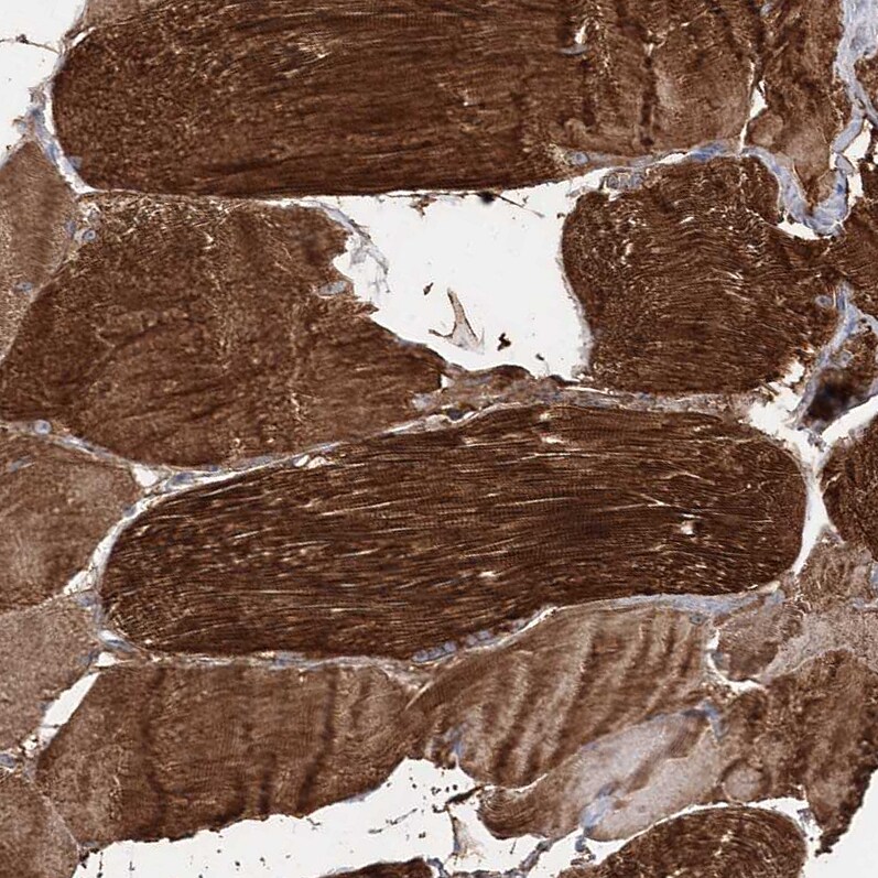 MLC1SA Antibody - BSA Free Immunohistochemistry: MLC1SA Antibody - BSA Free [NBP1-92124]
