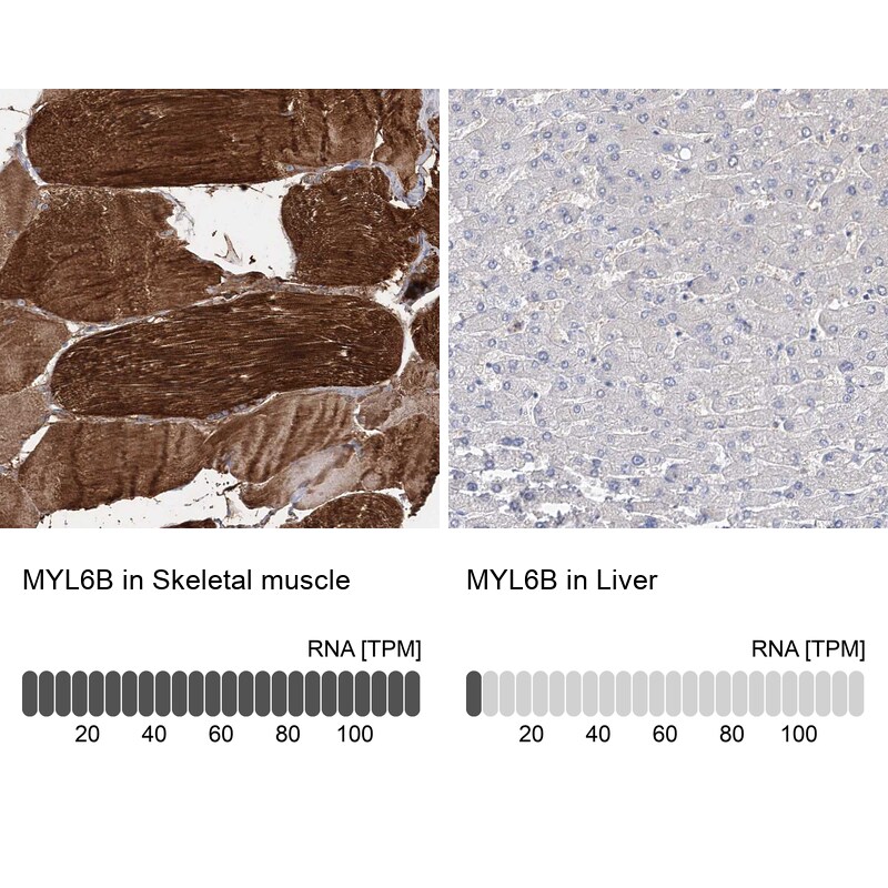 MLC1SA Antibody - BSA Free Immunohistochemistry: MLC1SA Antibody - BSA Free [NBP1-92124]