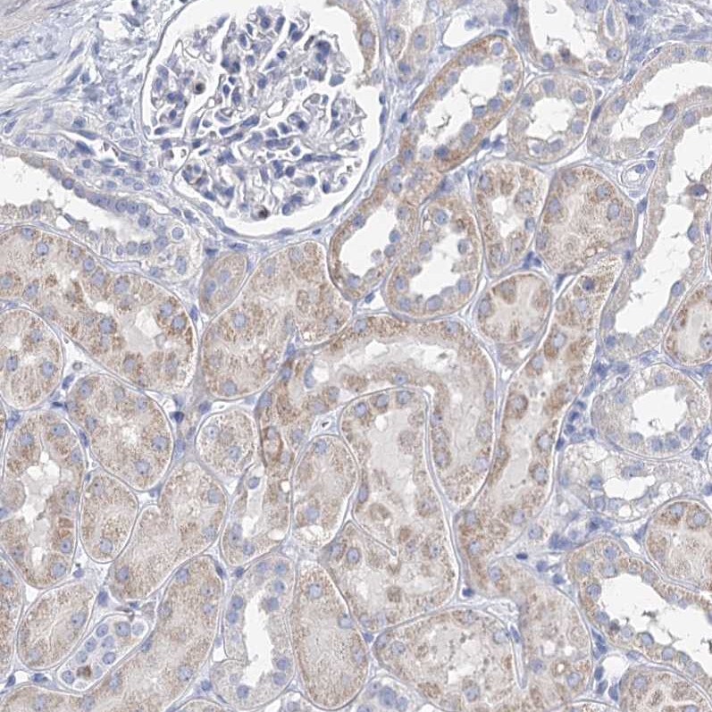 MLC1SA Antibody - BSA Free Immunohistochemistry: MLC1SA Antibody - BSA Free [NBP1-92124]