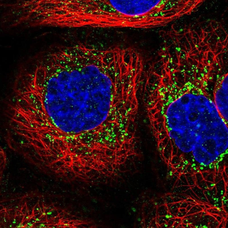 MLC1SA Antibody - BSA Free Immunocytochemistry/ Immunofluorescence: MLC1SA Antibody - BSA Free [NBP1-92124]
