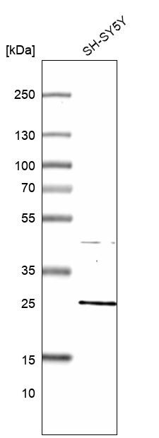MLC1SA Antibody - BSA Free Western Blot: MLC1SA Antibody - BSA Free [NBP1-92124]