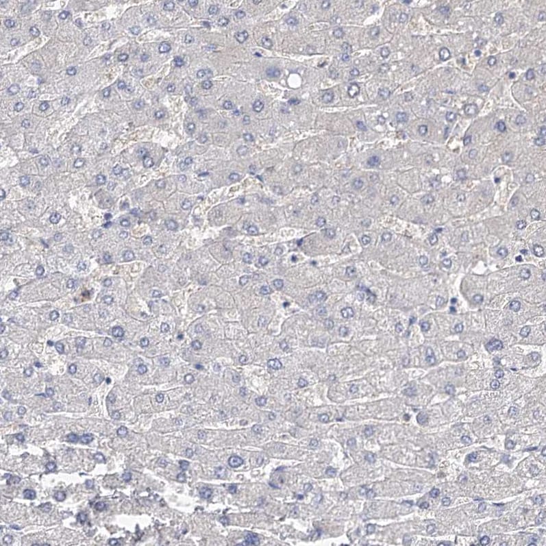 MLC1SA Antibody - BSA Free Immunohistochemistry: MLC1SA Antibody - BSA Free [NBP1-92124]