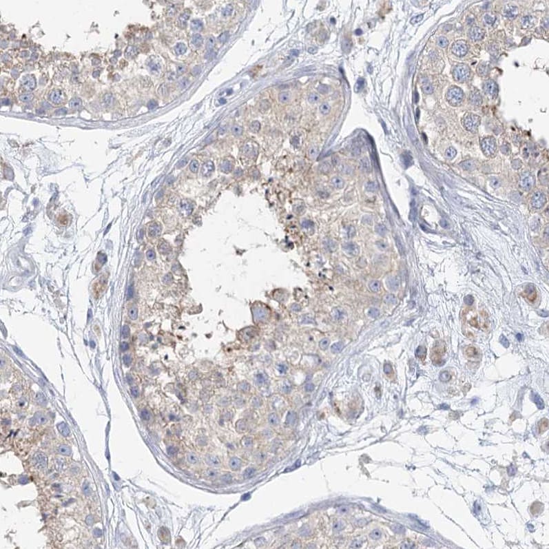 MLC1SA Antibody - BSA Free Immunohistochemistry: MLC1SA Antibody - BSA Free [NBP1-92124]