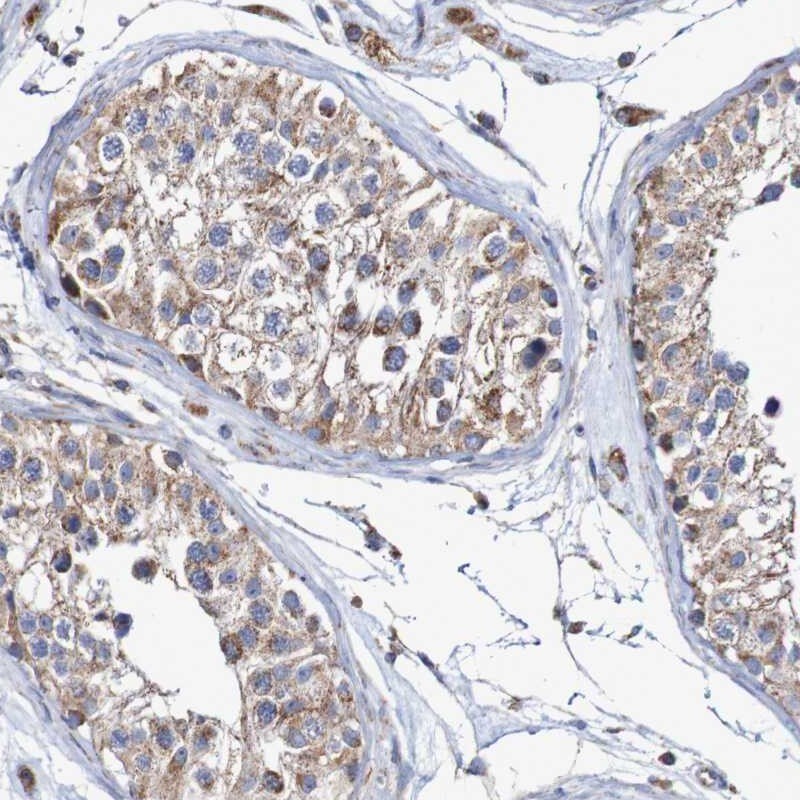 Neprilysin-2/MMEL1 Antibody - BSA Free Immunohistochemistry: Neprilysin-2/MMEL1 Antibody - BSA Free [NBP1-92125]