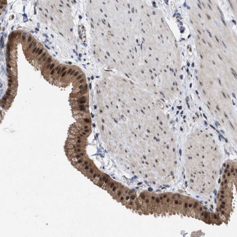 MNK2 Antibody - BSA Free Immunohistochemistry-Paraffin: MNK2 Antibody [NBP1-92129]