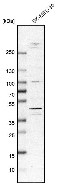 MNK2 Antibody - BSA Free Western Blot: MNK2 Antibody - BSA Free [NBP1-92129]