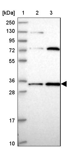 MRPL15 Antibody - BSA Free Western Blot: MRPL15 Antibody - BSA Free [NBP1-92137]