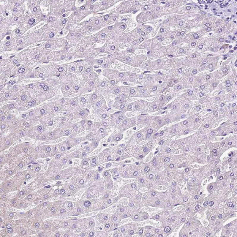 MRPL36 Antibody - BSA Free Immunohistochemistry: MRPL36 Antibody - BSA Free [NBP1-92139]