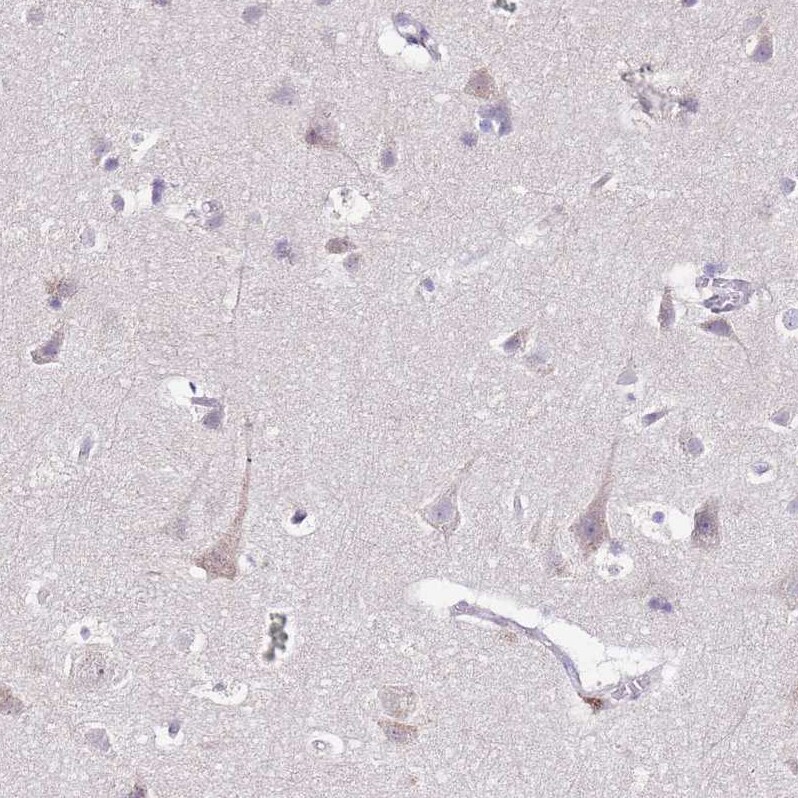 MRPL36 Antibody - BSA Free Immunohistochemistry: MRPL36 Antibody - BSA Free [NBP1-92139]