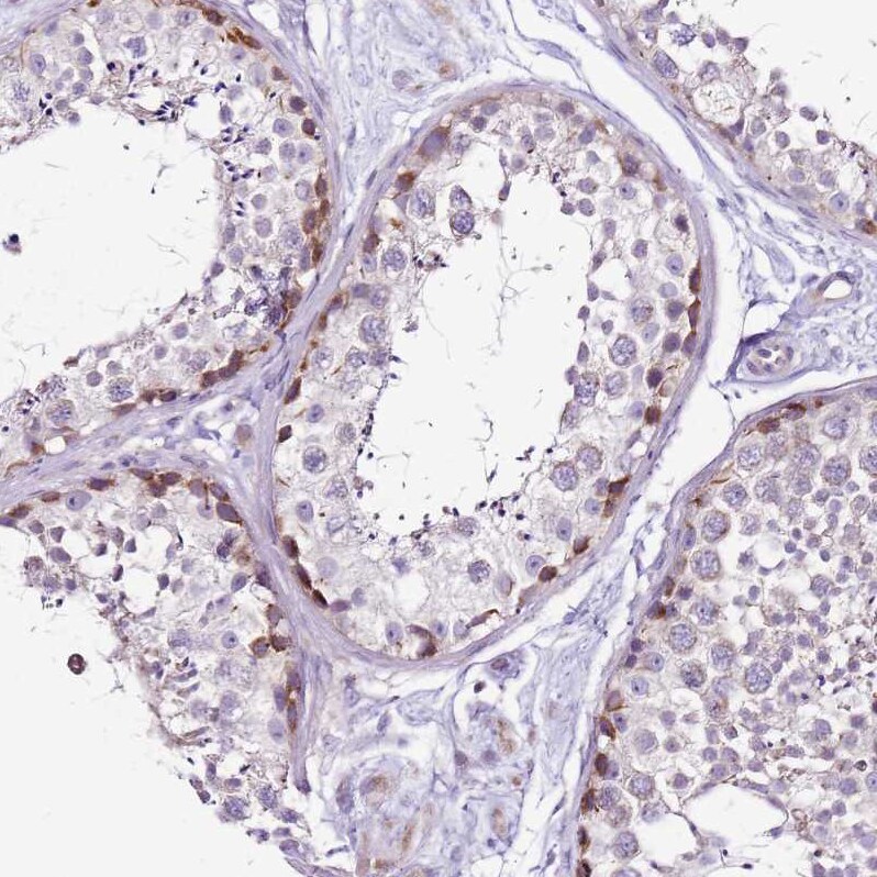 MRPL36 Antibody - BSA Free Immunohistochemistry: MRPL36 Antibody - BSA Free [NBP1-92139]