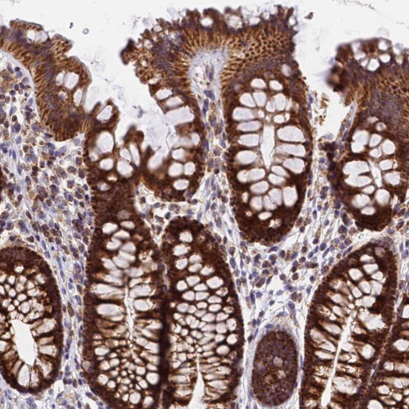 MRPS26 Antibody - BSA Free Immunohistochemistry: MRPS26 Antibody - BSA Free [NBP1-92141]