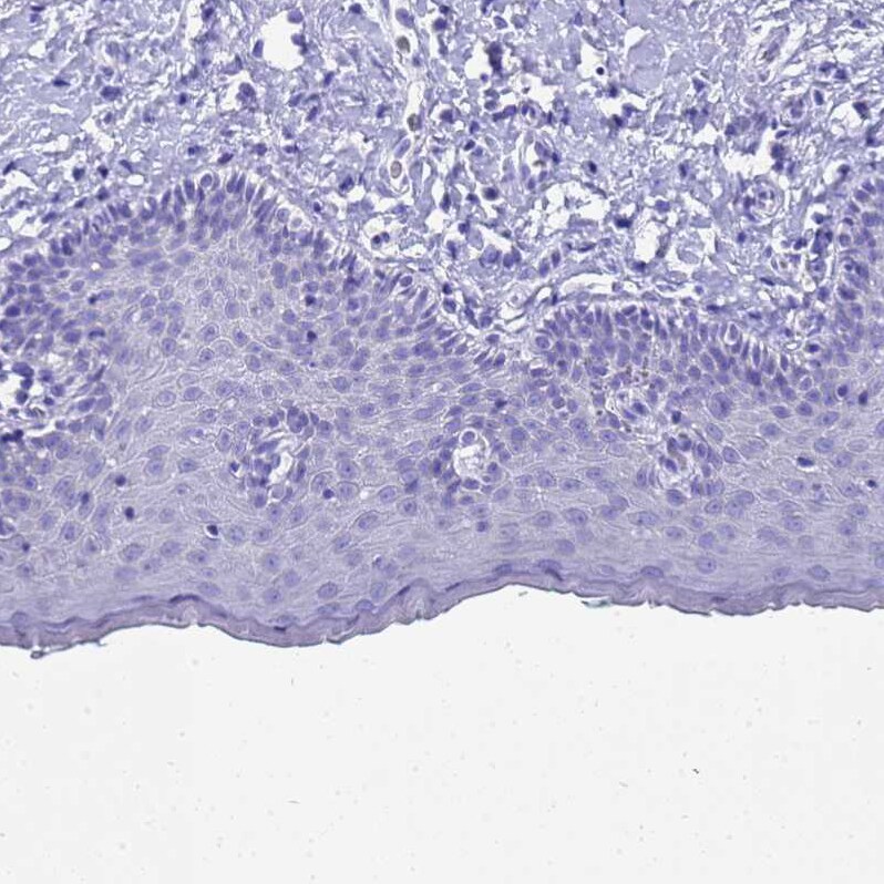 MS4A13 Antibody - BSA Free Immunohistochemistry: MS4A13 Antibody - BSA Free [NBP1-92142]