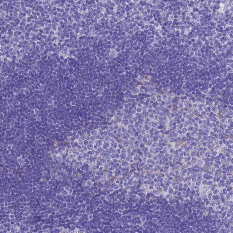 MS4A13 Antibody - BSA Free Immunohistochemistry: MS4A13 Antibody - BSA Free [NBP1-92142]